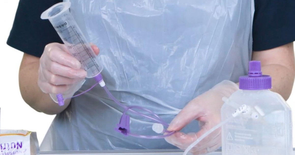The Use Of Blended Diets With Enteral Feeding Tubes The Use Of Blended Diets With Enteral Feeding Tubes