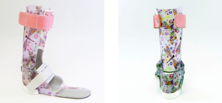 Photos of a hinged fixed ankle foot orthosis